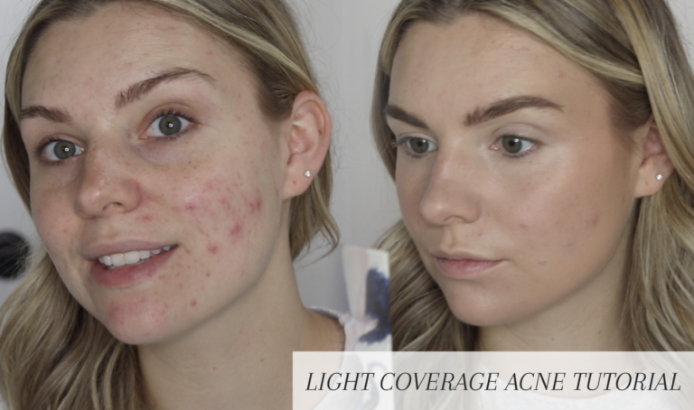 HOW TO EMBRACE YOUR NATURAL SKIN TEXTURE + FOCUS ON SPOT CONCEALING (EVEN WITH ACNE)